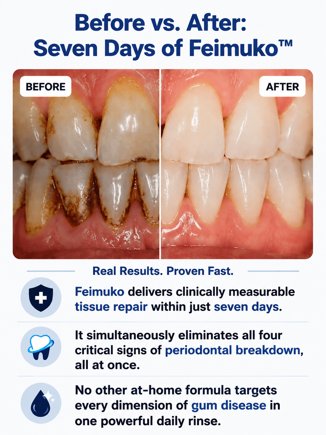 Feimuko™ Dissolves Tartar and Restores Your Gums Without Surgery