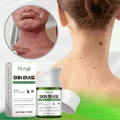 Hoygi SKIN ERASE：Erase Unwanted Marks in 7 Days Without Surgery, Pain, or $650 Doctor Bills