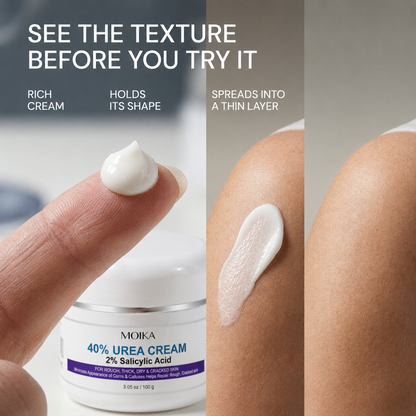 MOIKA — Advanced Keratolytic Cream For Rough, Raised Seborrheic Keratoses-K$