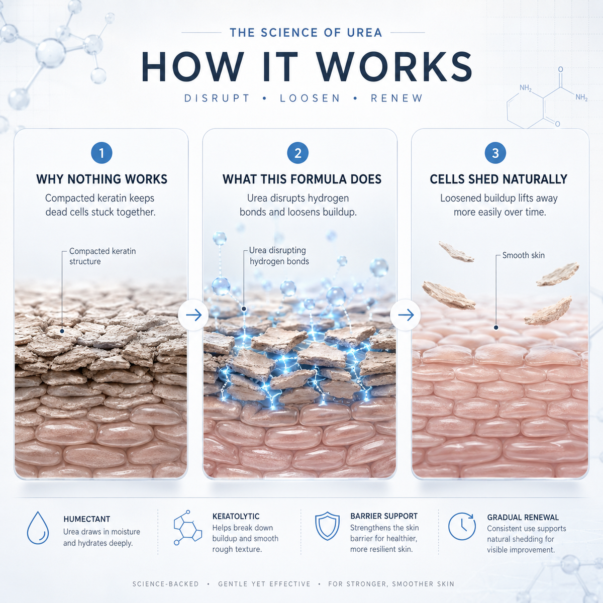 MOIKA — Advanced Keratolytic Cream For Rough, Raised Seborrheic Keratoses-K$