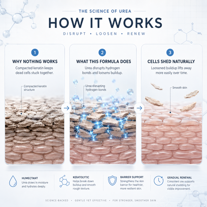 MOIKA — Advanced Keratolytic Cream For Rough, Raised Seborrheic Keratoses-K$