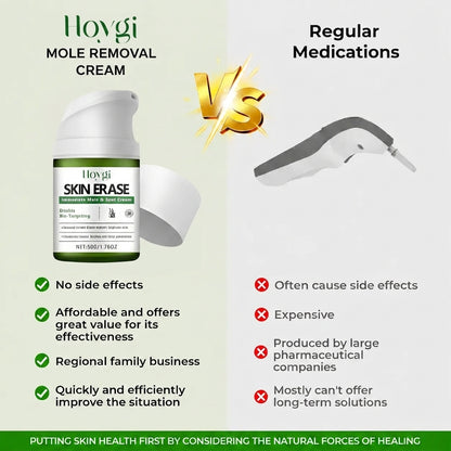 Hoygi SKIN ERASE：Erase Unwanted Marks in 7 Days Without Surgery, Pain, or $650 Doctor Bills